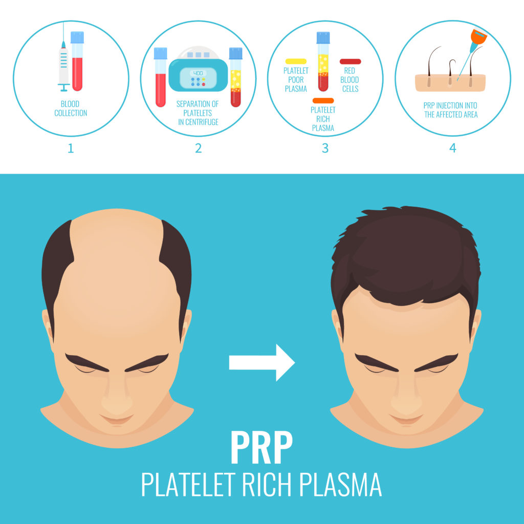 Greater Boston PRP Procedures offfered by GK Dermatology, PC